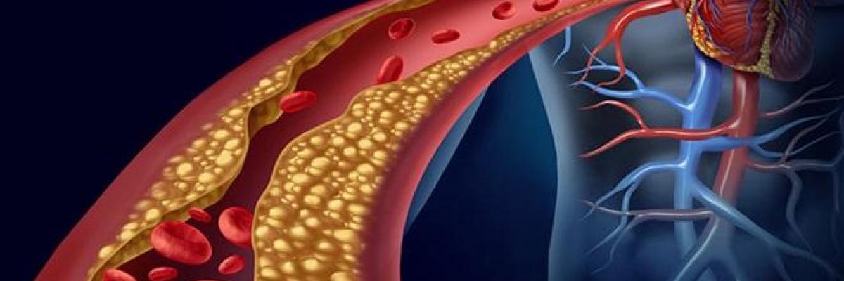 Cholesterol