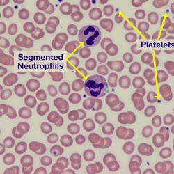 Blood smear Thumbnail